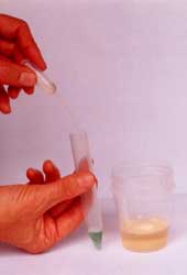 arsenic poisoning symptoms